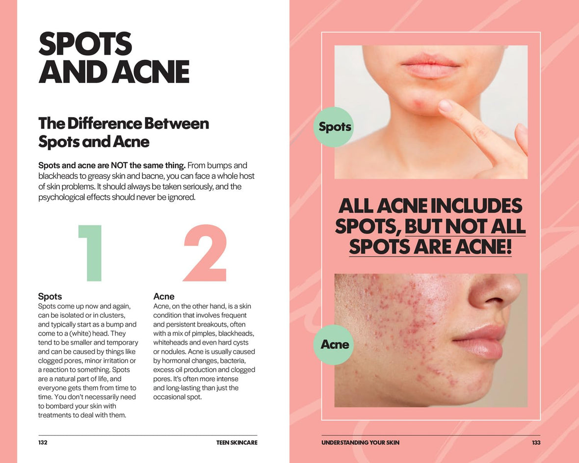 Teen Skincare: The Ultimate No Nonsense Guide